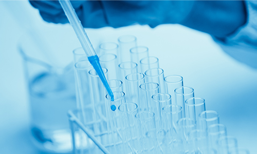 소변검사 및 Multi-PCR 검사